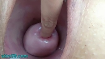 Brutal Sex: A Woman Inserts Nettles Into Her Vagina